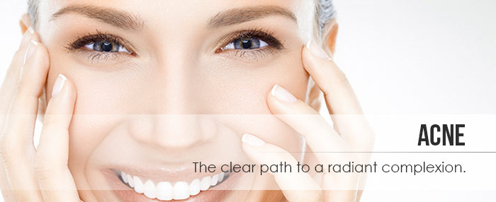 Acne Celluma