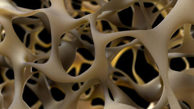 Free Bone Density Screenings