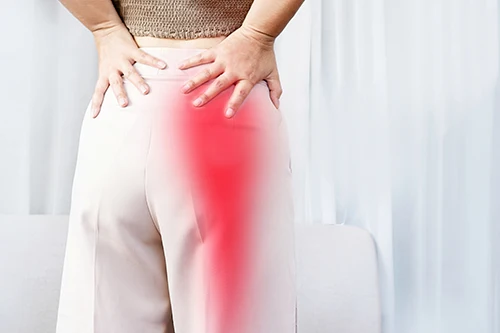 Village Family Clinic - Sciatica Pain