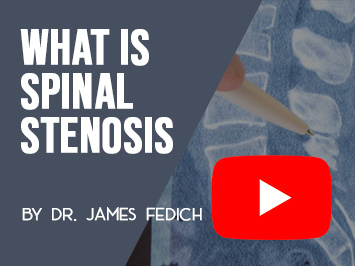 What is Spinal Stenosis