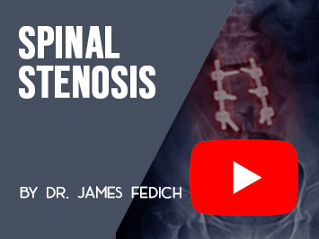 Spinal Stenosis